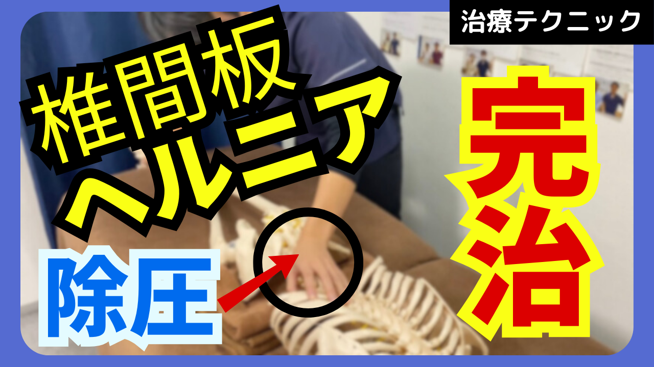 なかなか改善しない椎間板ヘルニアを完治させる椎間板の除圧テクニック！！